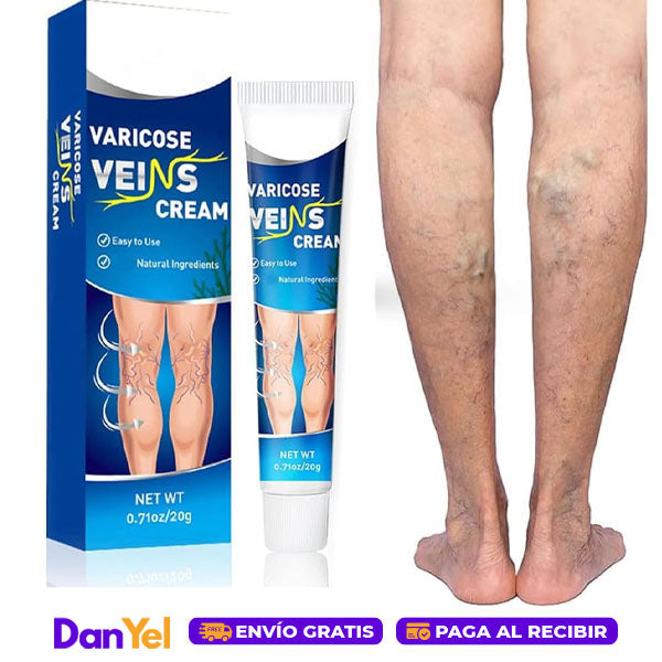 Crema para Aliviar las Varices