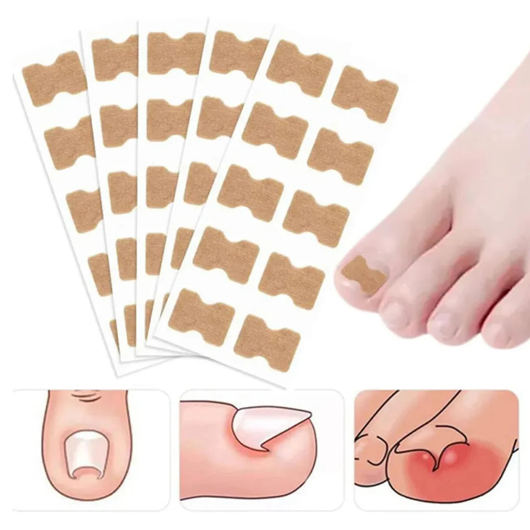 Parche Corrector de Uñas | 100 Parches | 2x1
