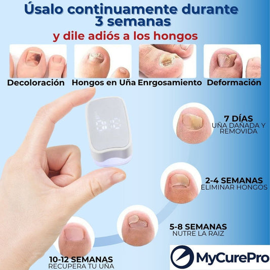 Eliminador Láser Antihongos