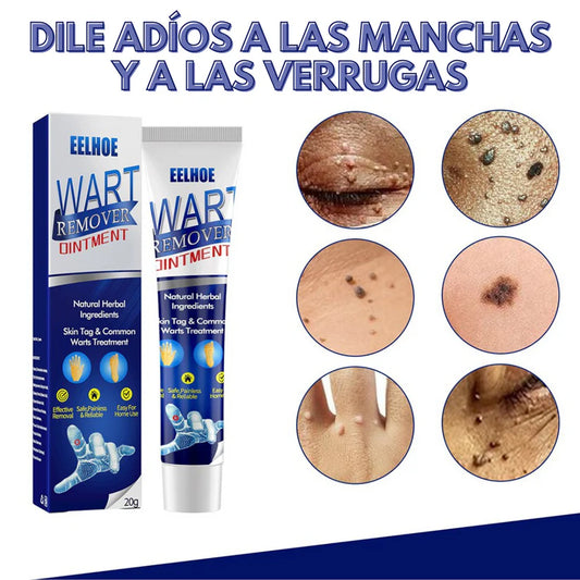 Crema para Eliminas Verrugas