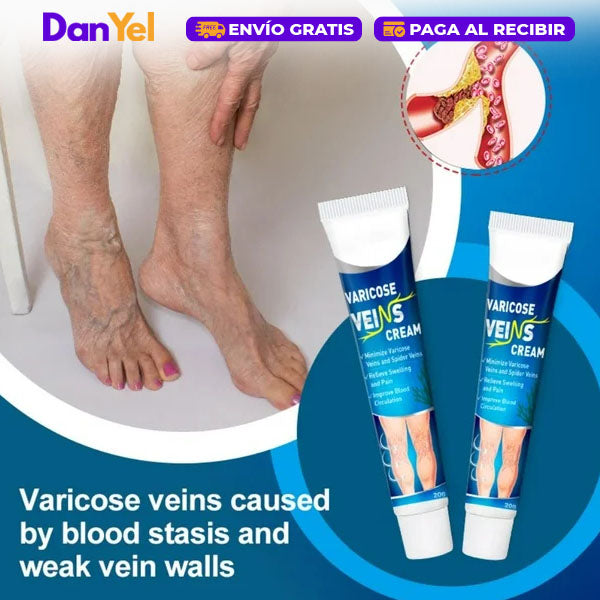 Crema para Aliviar las Varices
