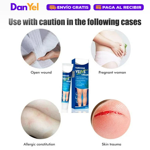 Crema para Aliviar las Varices