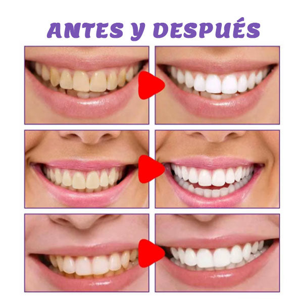 Crema Dental Blanqueadora