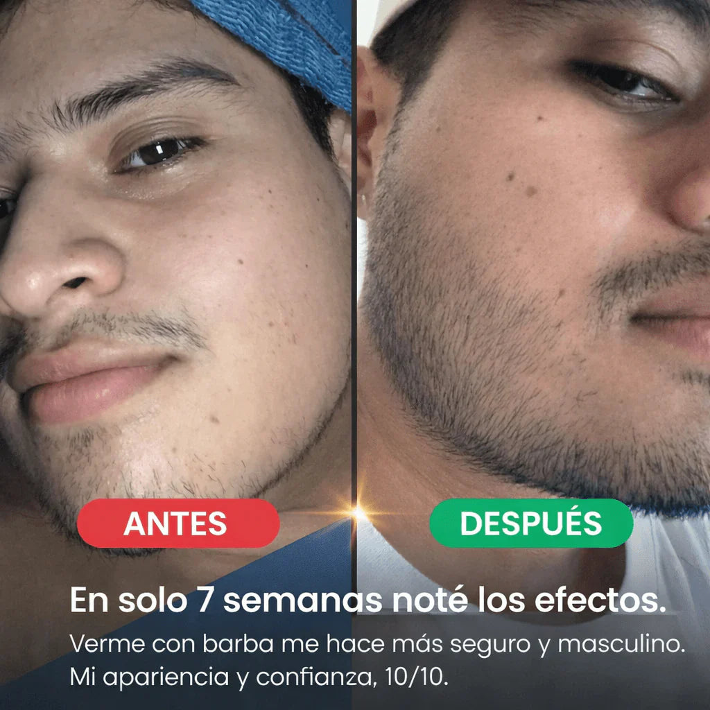 Bálsamo para el Crecimiento de la Barba | Minoxidil al 20%