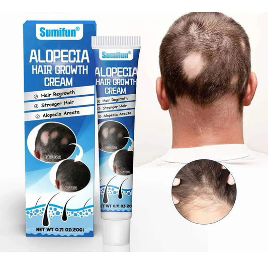 Crema para el Tratamiento de la Alopecia