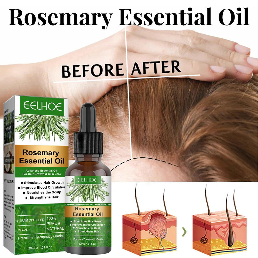Aceite de Romero para el Crecimiento del Cabello | ELLHOE