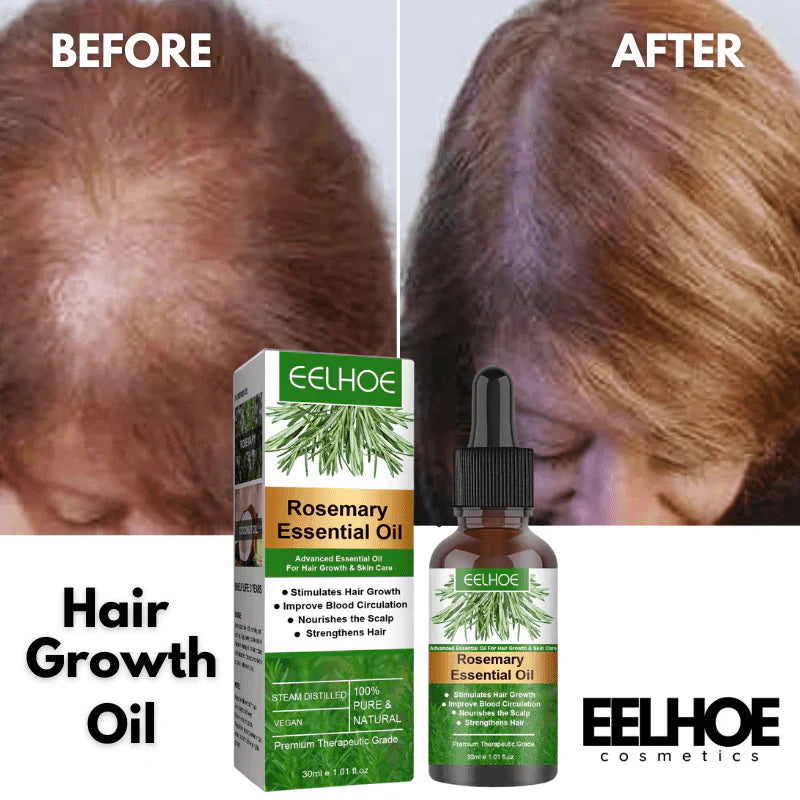 Aceite de Romero para el Crecimiento del Cabello | ELLHOE
